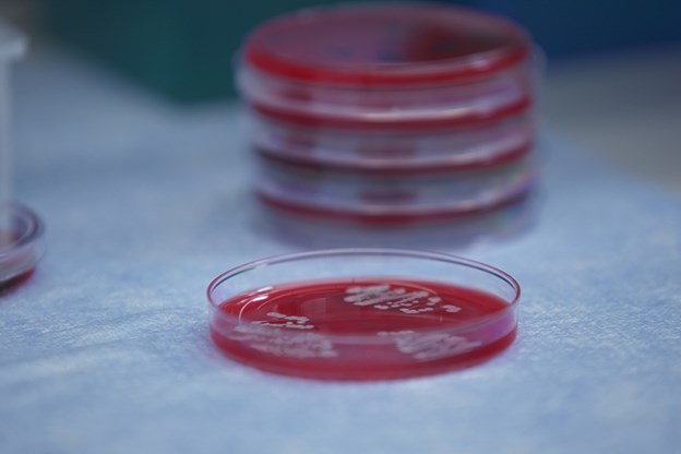 Bacteria in a petri dish