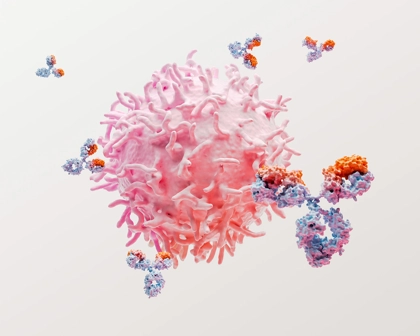 Lupus eritematoso sistemico